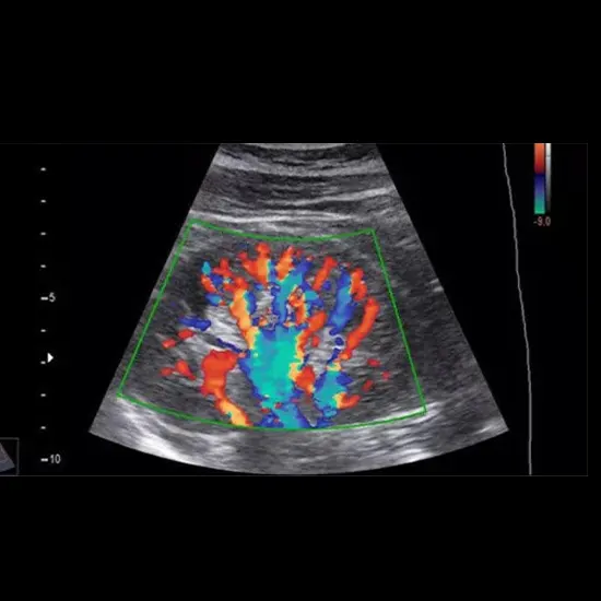 What are the Benefits of the NABH-Accredited Ultrasound Center for Color Doppler?